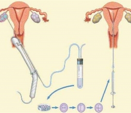 35岁女性备孕请做好以下检查，“健康北京代生宝宝”跑不远
